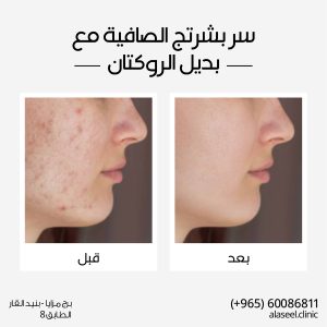 بدير الركتان هو مستحضر طبيعي مشتق من زيت الركتان، وهو زيت طبيعي مستخرج من بذور نبات الركتان