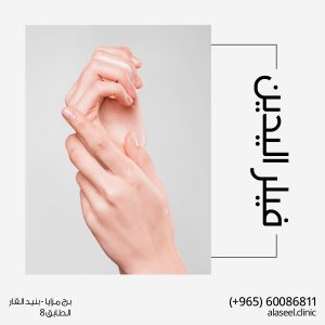 فيلر اليدين