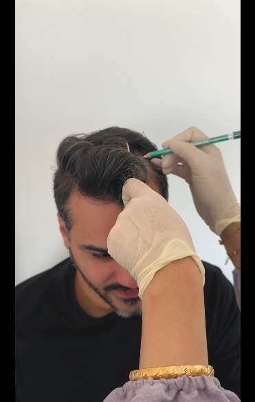 كورس كثافة الشعر